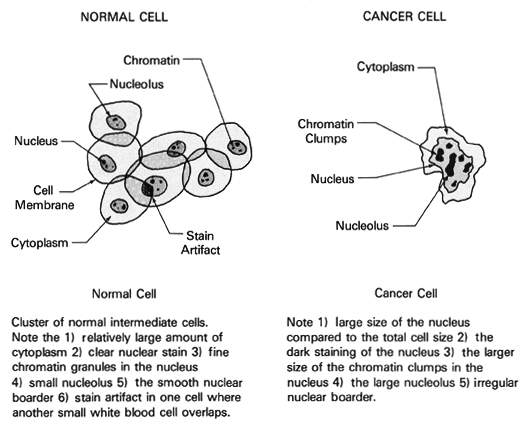 cancer cells pictures. normal and cancer cells