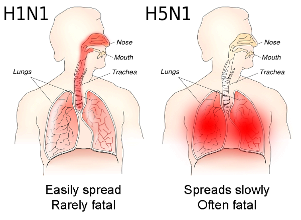 H1N1 versus H5N1 pathology