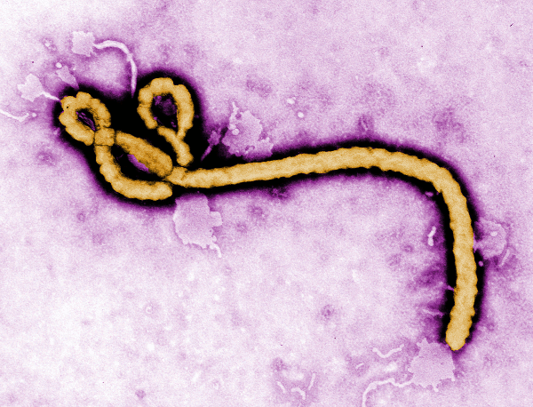 Ebola colorized