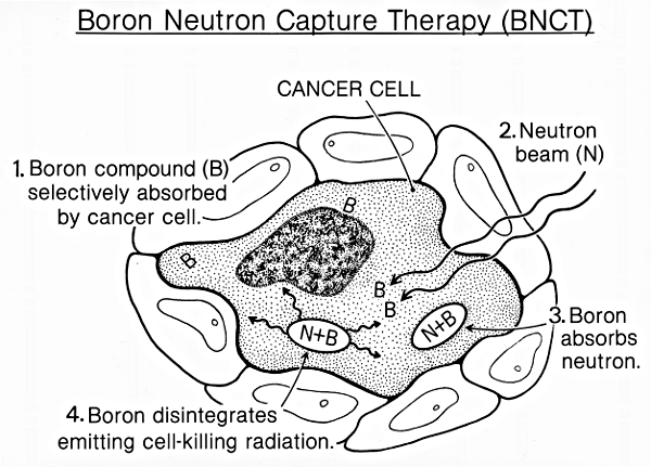 therapists clip art. Boron neutron capture therapy