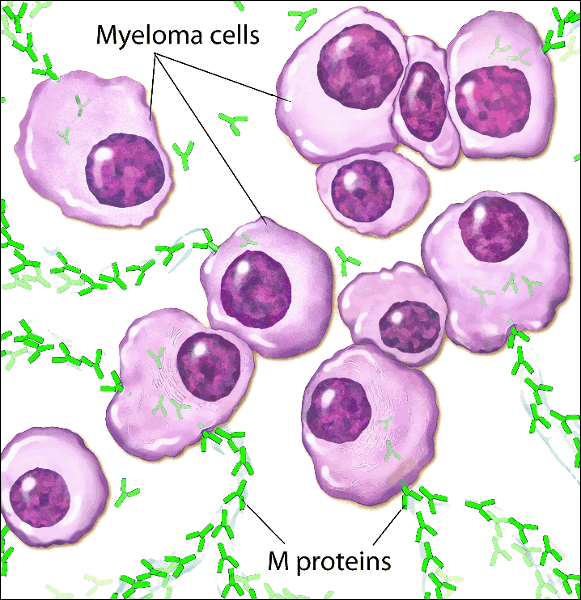 Myeloma Cells