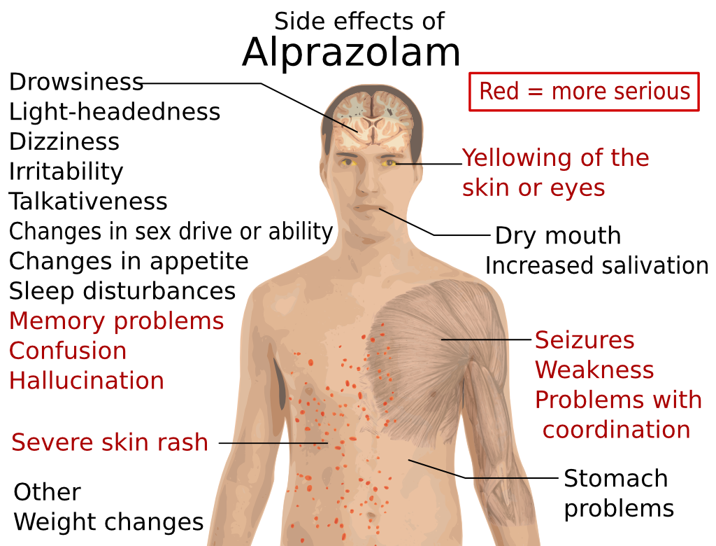 alprazolam side effects