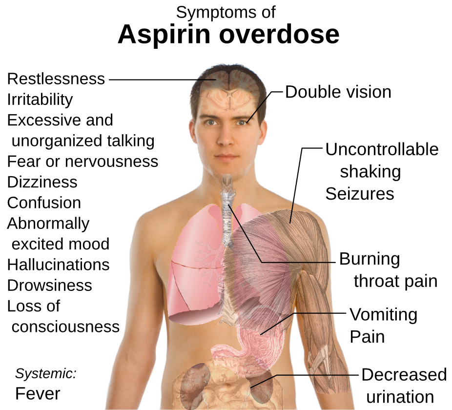 aspirin overdose symptoms